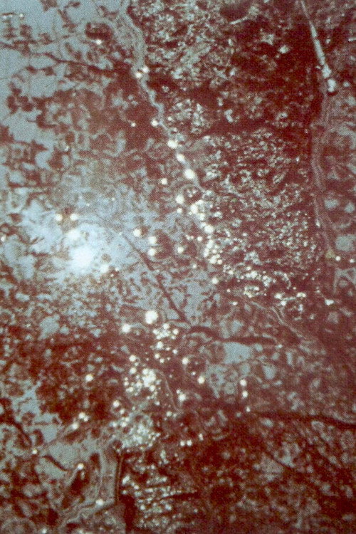 Lysis poster