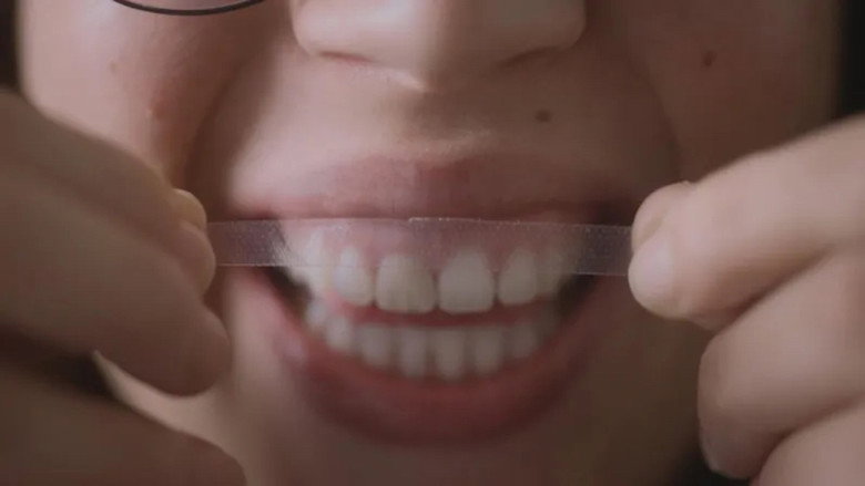 Des dents blanches... au rire jaune ! still 2